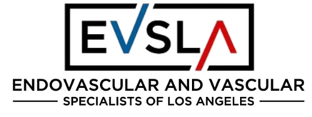 EVSLA